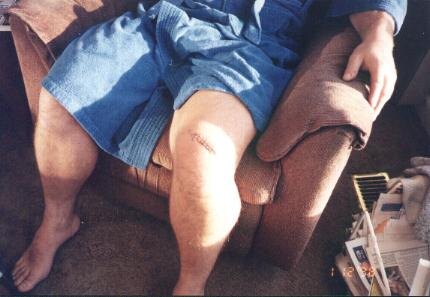 Ice Story Brown's Marina injuries for the storm